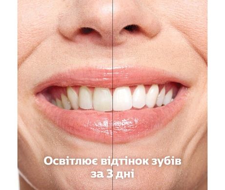 Електрична зубна щітка Philips DiamondClean 9000 HX9911/27