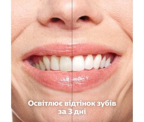 Електрична зубна щітка Philips DiamondClean 9000 HX9911/27  Фото №4
